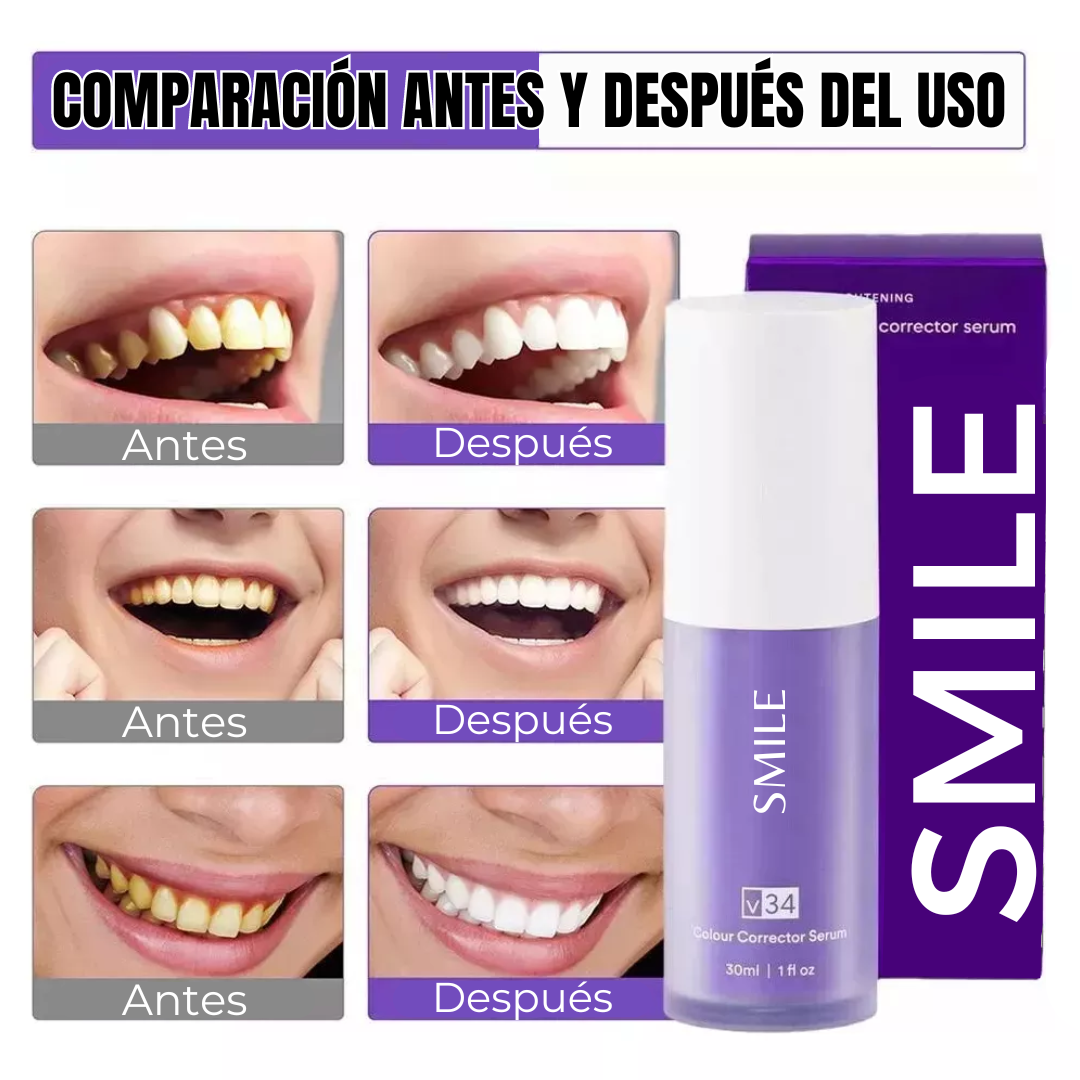 Blanqueador Dental SMILE V34